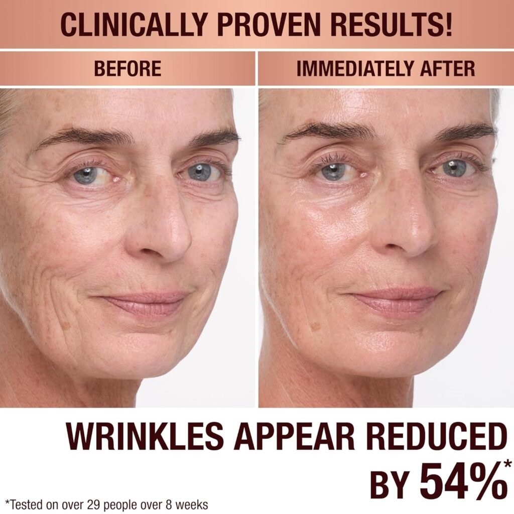 Before and after comparison photos of an older woman's face. The Before image shows visible wrinkles around the eyes and cheeks. The Immediately After image shows smoother, glowing skin with a text overlay stating Wrinkles appear reduced by 54%.
